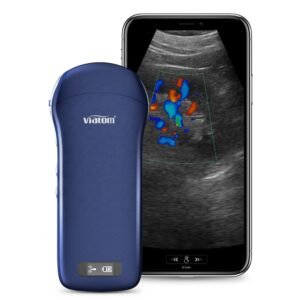 Smartphone Ultrasound Price Wireless Charing Scanner Machine Linear/Convex/Cardiac 3-in 1 Probe Portable Ultrasound