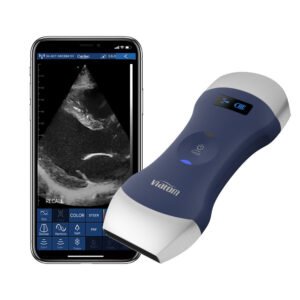 Wireless Handheld Ultrasound Scanner Weight 260g/0.6 lbs Compatible With Tablets And ios/android Portable Ultrasound